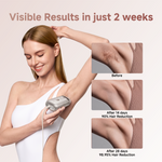 Load image into Gallery viewer, Dreame Nova IPL Hair Removal Device